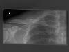 [thumbnail of Picture 1]