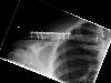 [thumbnail of Picture 5]
