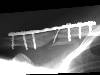 [thumbnail of Picture 6]